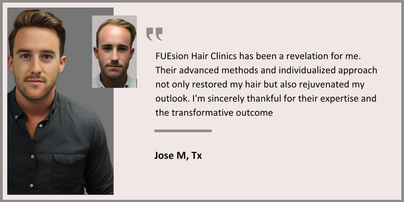 Beverly Hills Hair Transplant Surgeons - Male Hair Transplant Testimonial