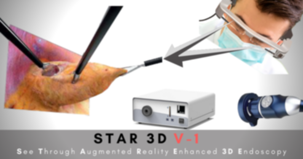 STAR 3D V-1 | 3D Endoscopy System
