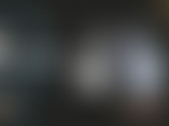 What is the New Technology for Hair Restoration? Exploring HARRTS FUEsion X, ARTAS, and NeoGraft