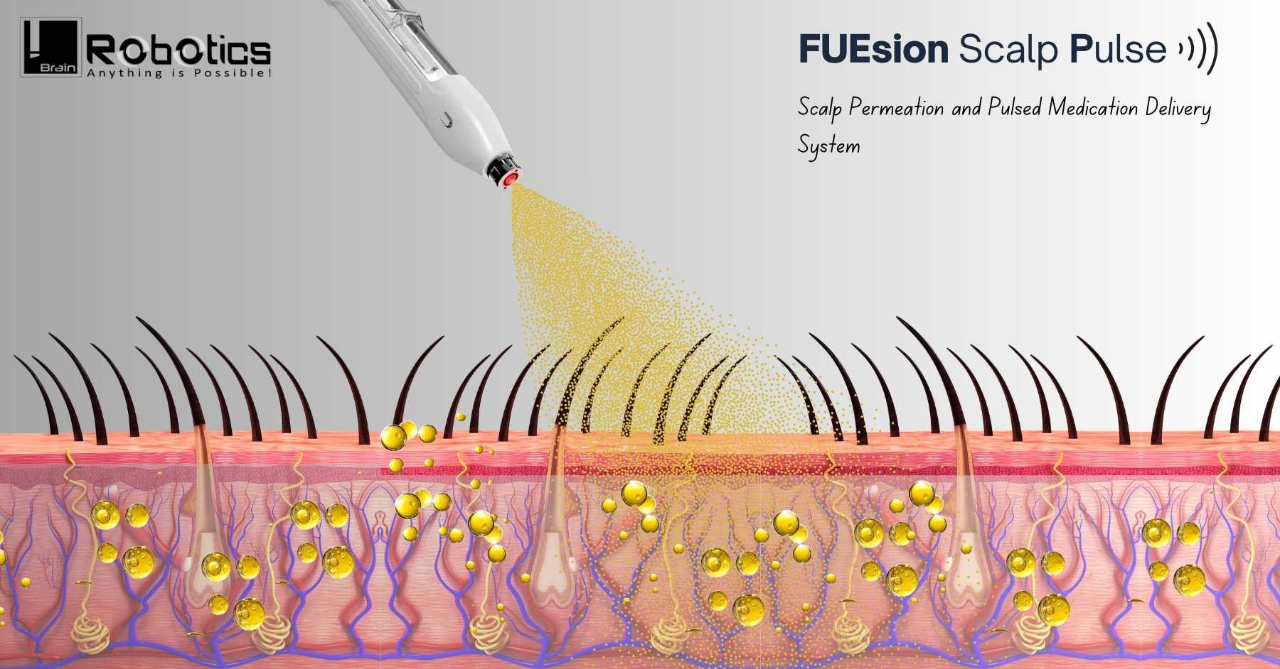 Non Surgical Hair Restoration Techniques Embracing a New Era of Hair
