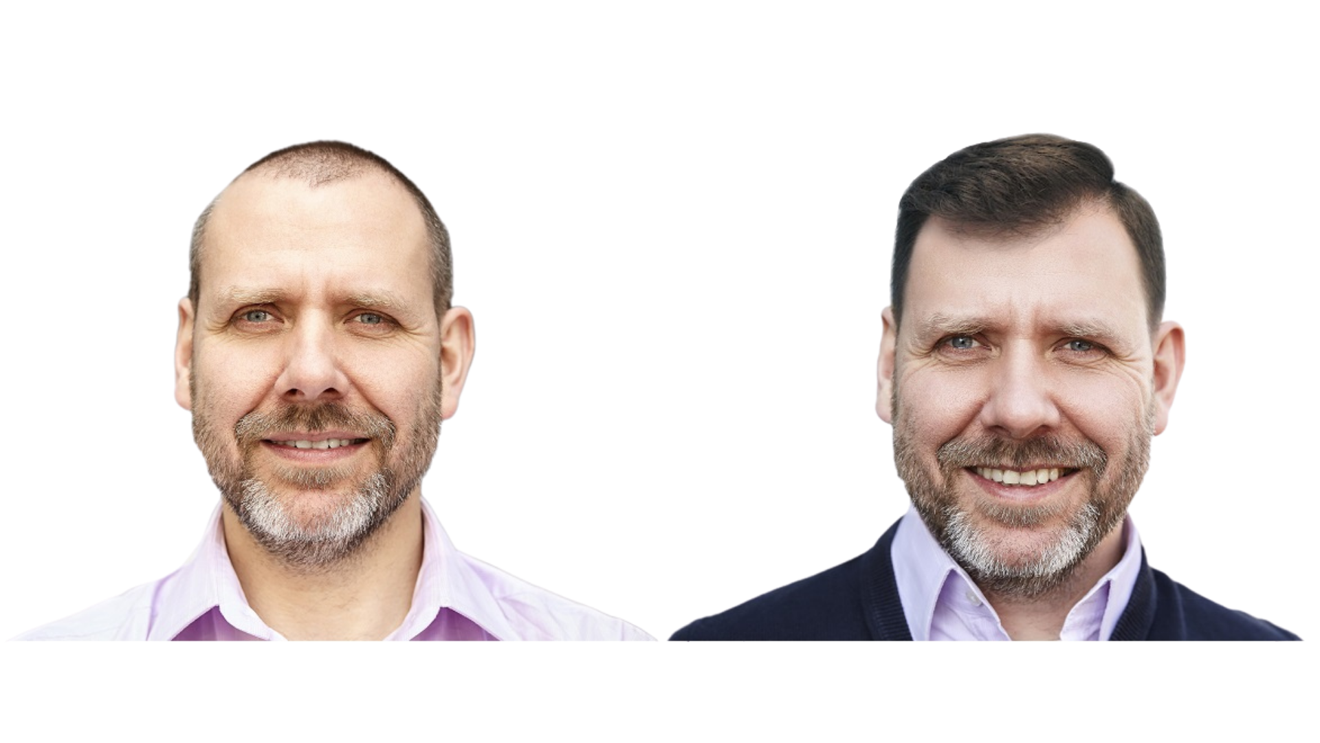Hair Transplant Before & After — FUEsion Hair Clinics Patient Result