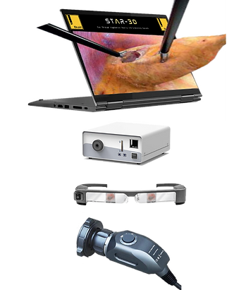 STAR 3D Endoscopy System