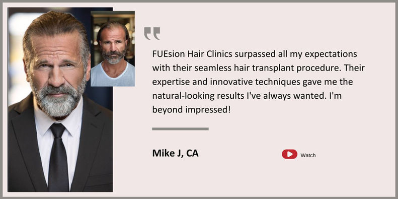 Hair Transplant Beverly Hills - Male Hair Transplant Testimonial