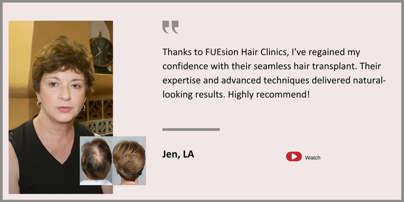 Beverly Hills Hair Transplant Surgery - Beverly Hills Hair Transplant - Female Hair Transplant Testimonial