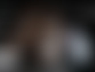 What is the Best Hair Transplant Technique 2024? Unveiling Top Technologies