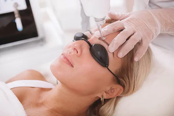 Eyebrow Tattoo Removal