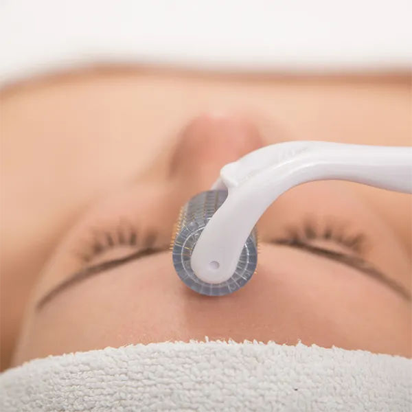 Close-up of a microneedling facial treatment at Revive Spa & Lash Lounge, a trusted med spa in Southern Pines for advanced skincare.