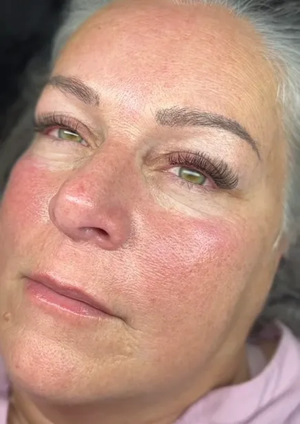 Facial glow and lash fullness after customized skincare and extensions.