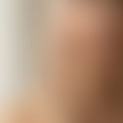 Woman touching her face after a hyaluronic acid treatment at 50