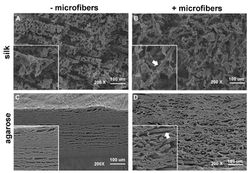 SEMs of fiber-reinforced hydrogels