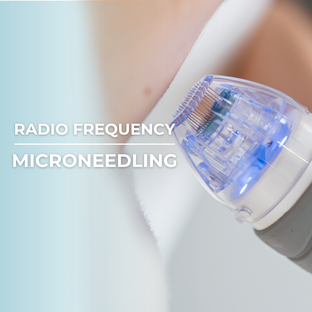Microneedling with Radio Frequency (RF) - Course of Three