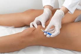 Stem Cell Injection