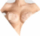 Breast reduction
