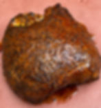 Turkey Breast