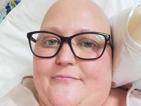 Hair Today Gone Tomorrow: Dealing With Hair Loss