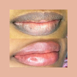 Lip Neutralization.jpg