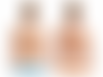 Adult scoliosis pain