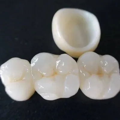 Dental Crowns