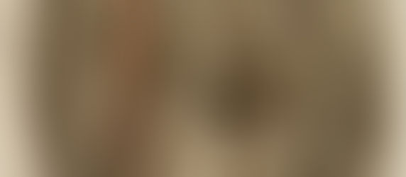 Funes el memorioso. Un caso de amnesia disociativa