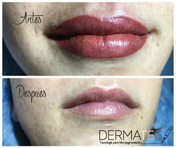 arte-21derma