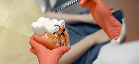 dental filling.jpg