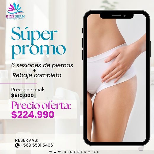Promocion Depilacion Laser piernas rebaje completo kinederm 2.1
