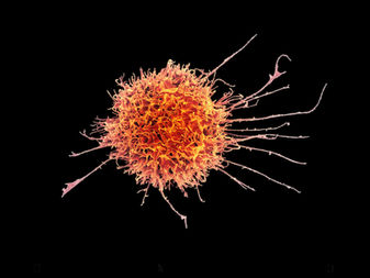 Supercharged natural killer cells suppress solid tumors in mice
