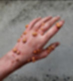 Silicone Boils Prosthetic - KjayFX - Australian Made FX