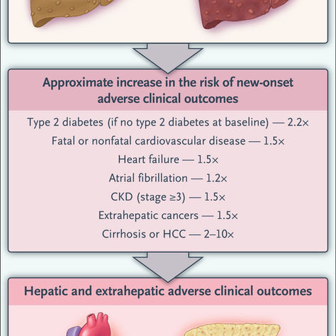 hepatic steatosis diagnostic criteria 