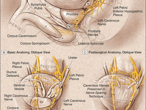 Anatomical model showing nerves critical for erectile function around the prostate gland.