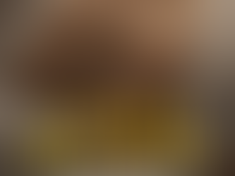 Finalmente, o Fim da "Pochete": Lipo Sem Cortes para uma Barriga Lisa