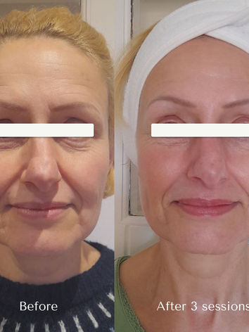 facial massage Northampton