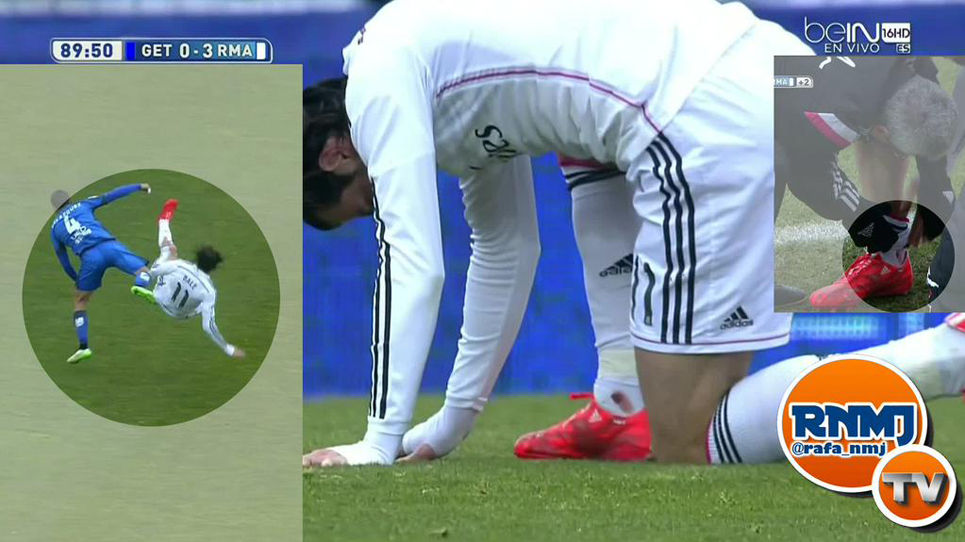 Bale_Tobillo_22_original.jpg