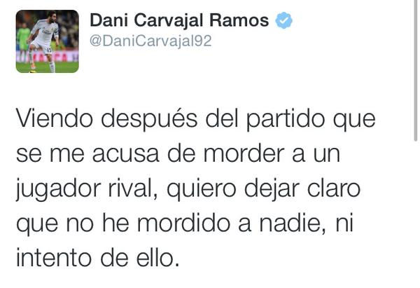 Mandzukic: "No hay mordisco"