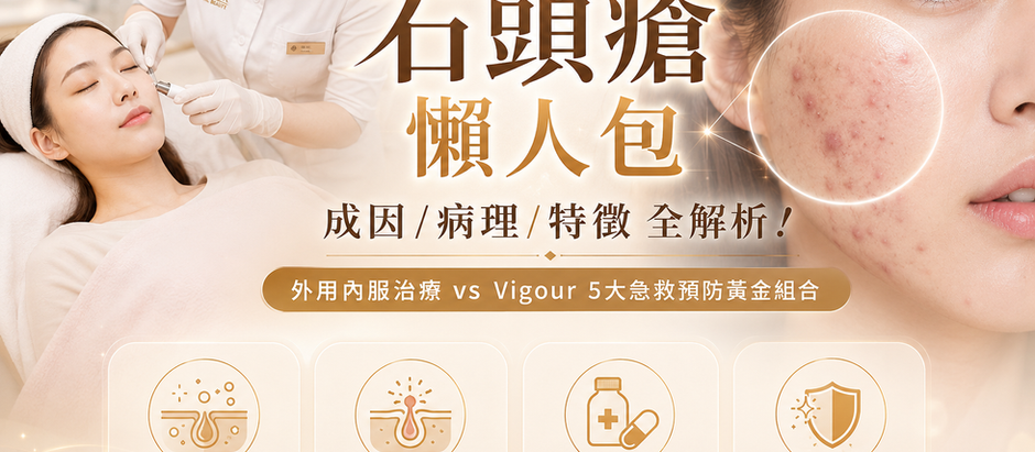 【石頭瘡懶人包】成因/病理/特徵全解析！外用內服治療 vs Vigour 5大急救預防黃金組合