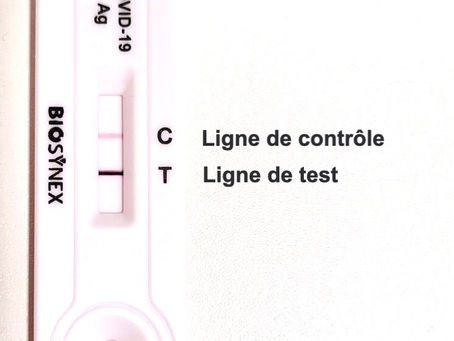 Test rapide antigénique : vraiment fiable ?