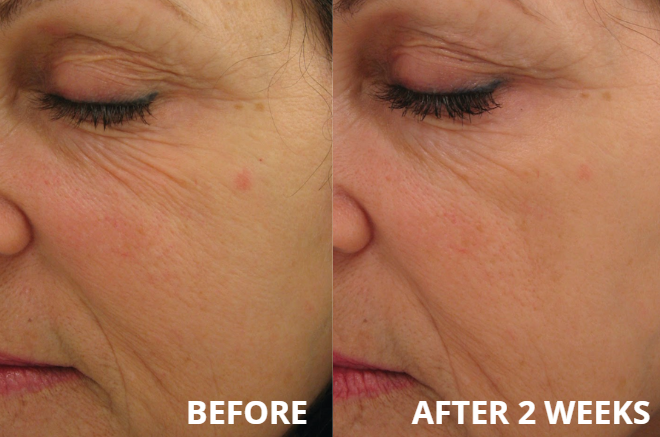 Power serum & Power lift