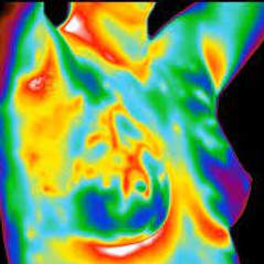 Thermal Imaging Breasts