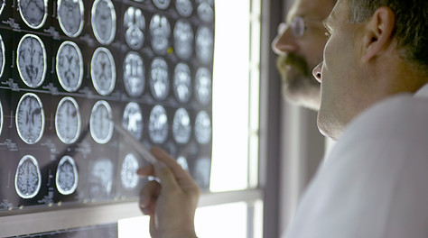 Médicos analisando exames cerebrais