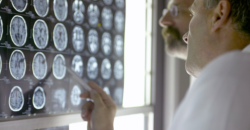 Doctors Looking at X- Rays