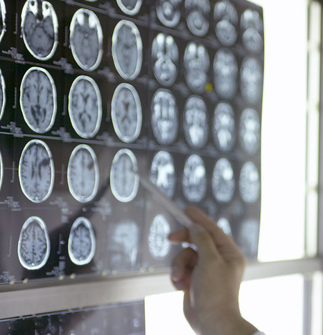 Doctor Analyzing X-Rays