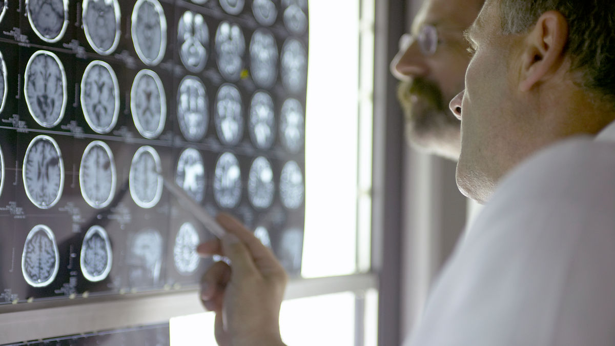 Neurologia