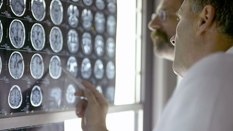 Doctors Looking at X- Rays