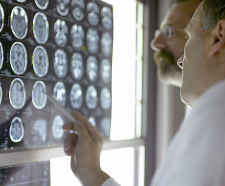 Doctors Looking at X- Rays