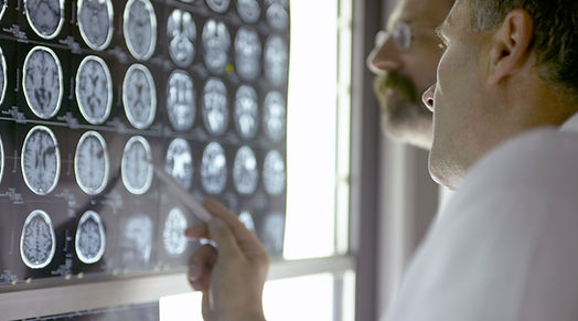 Doctors Reviewing Brain Scans