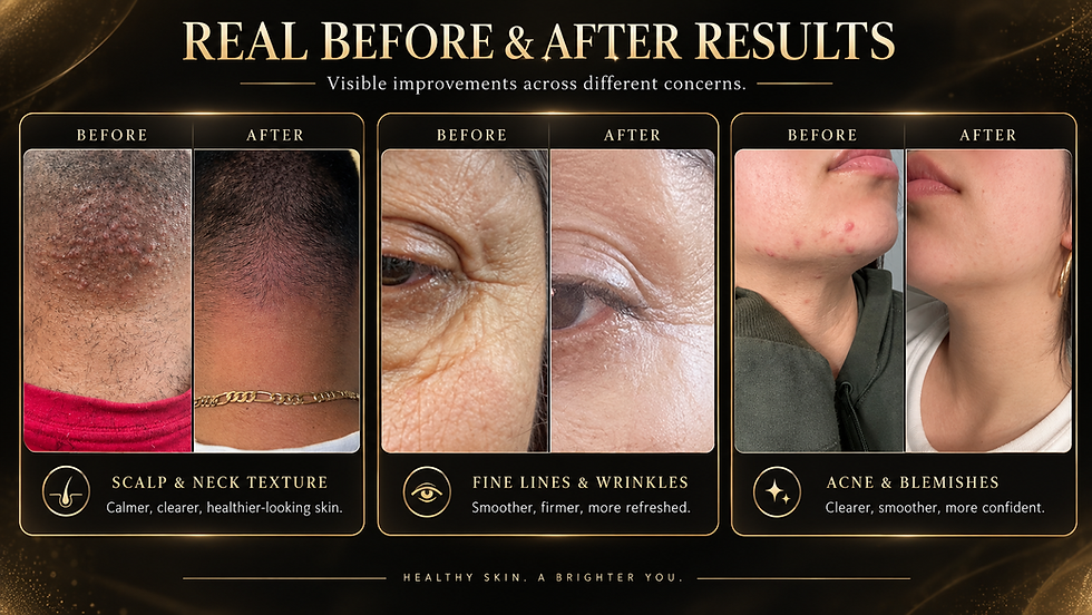 Norashiram before and after results. Wrinkles, acne, psoriasis, eczema