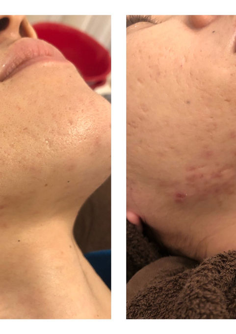 image_6483441 (2).JPG