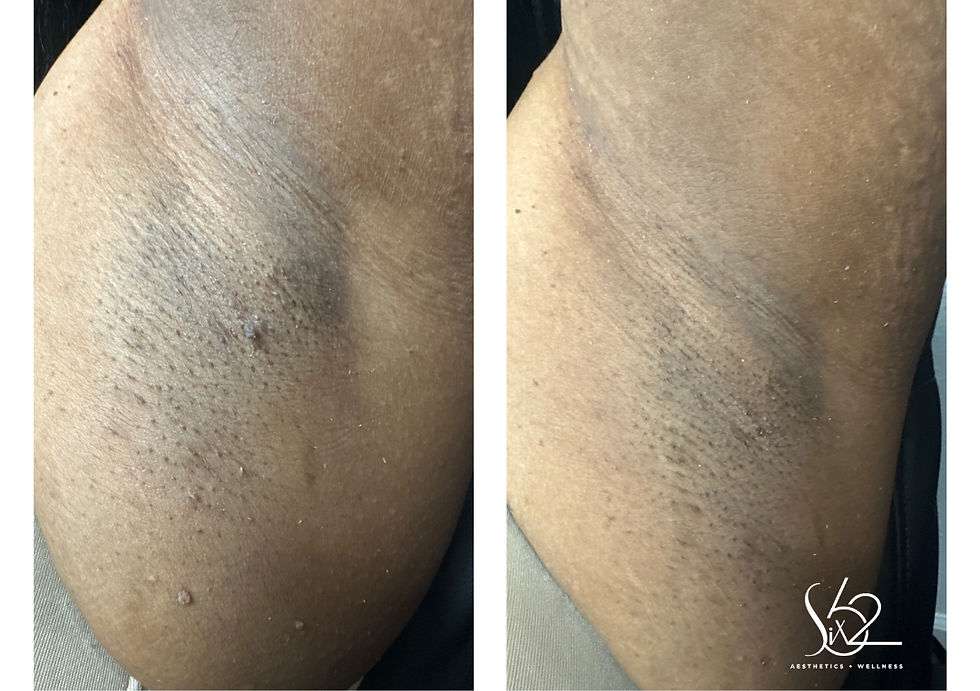 Copy of Copy of Before  (7)_edited.jpg