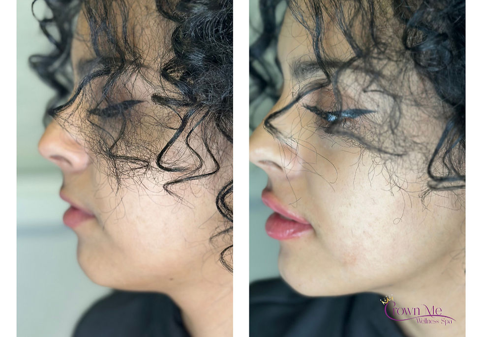 Copy of Copy of Before (2)_edited.jpg