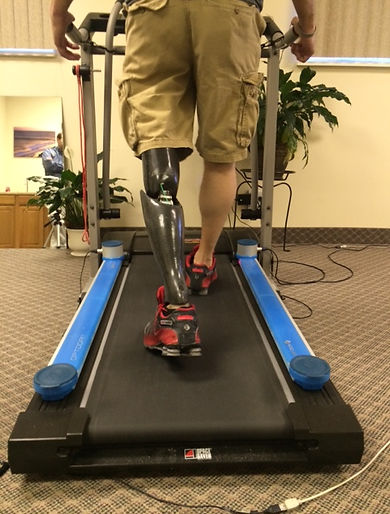 Prosthetic Gait Analysis.JPG